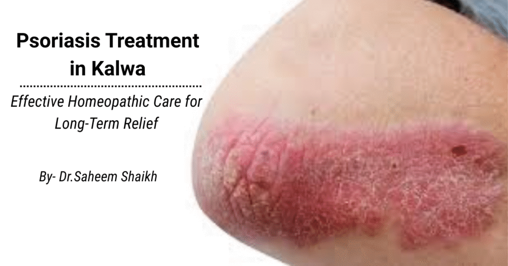 psoriasis treatment in kalwa